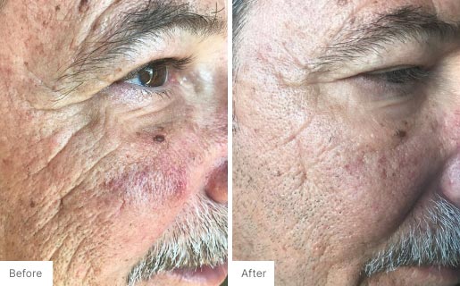 2 - Before and After Real Results of Age IQ Day Cream on a man's face