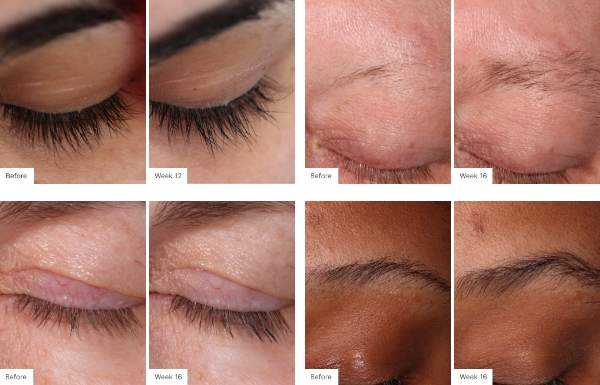 Before and after images from clinical study of Lash Lush Serum