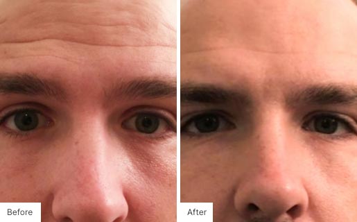 9 - Before and After Real Results image for Age IQ Night Cream